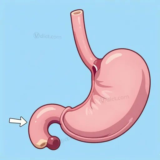 distensible